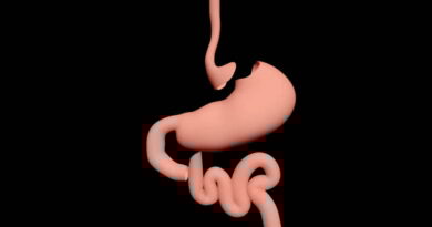 Gastric bypass surgery in Abu Dhabi