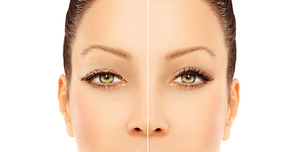 Fat Transfer Surgery in Abu Dhabi