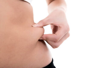 Tummy Tuck in Abu Dhabi