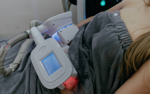 CoolSculpting Explained Safe Fat Reduction