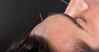 Crown Hair Transplant in Abu Dhabi